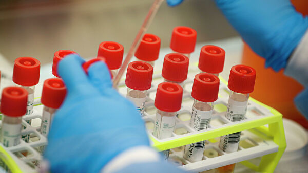  Бонецкий лабораториясына пандемия маалында бааларды жогорулаткан үчүн 423 млн сом айып салынды