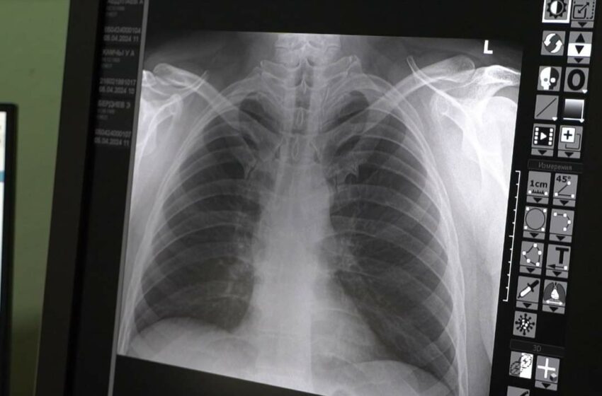  В организации здравоохранения поставлены 20 цифровых рентгено-флюорографических аппаратов